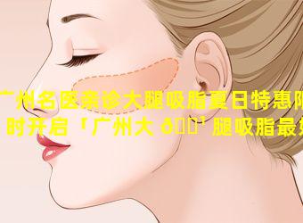 广州名医亲诊大腿吸脂夏日特惠限时开启「广州大 🌹 腿吸脂最好的 🍁 医生」